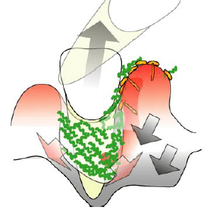 歯周病はこのように進行していきます